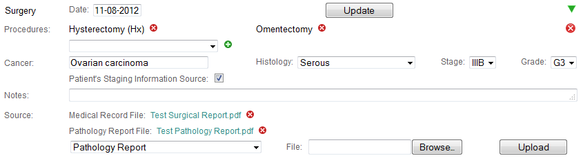 Surgery history event in the detailed display mode in Colabrativ's Clinical Entry and Operations (Cleo) application.  All of the personal information displayed in this figure is fictitious, and does not represent a real individual or their medical history.